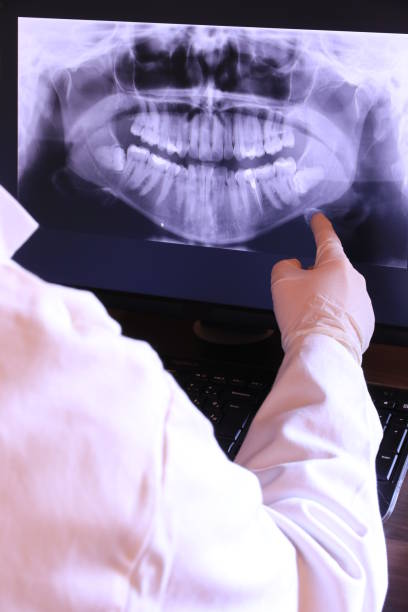 Best Emergency Treatment for Dental Infections or Abscesses in Glenwood, IA